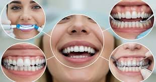 4 Popular Cosmetic Dental Treatments That Deliver Quick Results